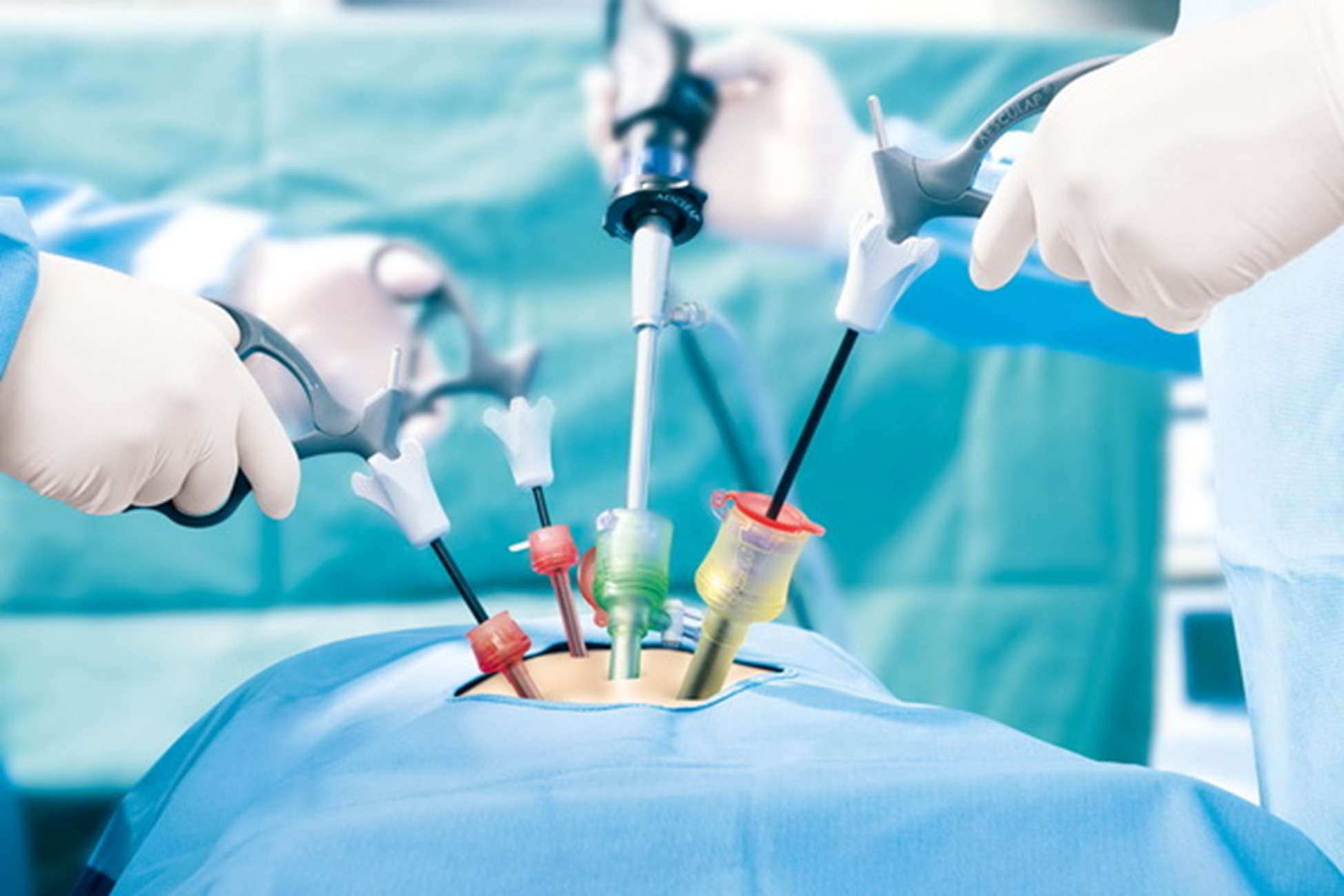 IVF in bapunagar